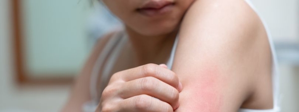 The Effects of Hard Water on Your Body Photo